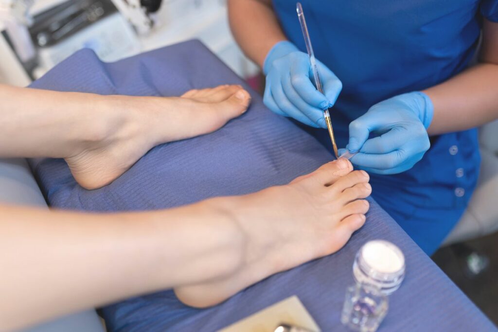 rekonstrukcja paznokcia w gabinecie podologicznym